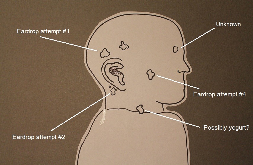 How to Administer Ear Drops to a Baby When You Are Home By Yourself